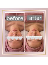 ベルメール(Bellemer)/アンストレス施術のお客様♪