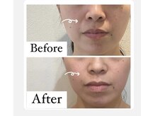 ワイグレイス(Y.GRACE)/4Dフェイシャル