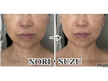 ノリスズ(NORI SUZU)/6つの老け脂肪にアプローチ