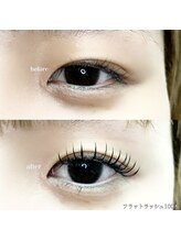 ソルテ バイ アフェリーチェ(sorte by afelice)/フラットラッシュ100本/麻布十番