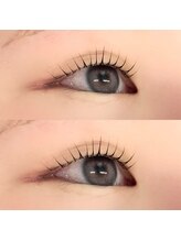 ソア 並木坂店(Soa)/根元からしっかり上がるまつ毛♪