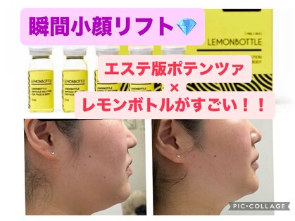 ジェミー(Gemmy)の写真