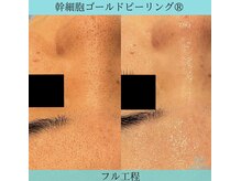 リメイク 広尾(REMAKE)/