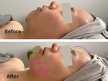 ニッコ(nicco)/アロマリンパ小顔フェイシャル