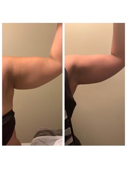 ナチュレアンドメディカ(Nature&Medica)/オンダ痩身は唯一の効果と価格