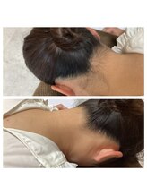 リグ 郡山店(LIG)/うなじスッキリ