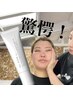 【話題のフェイスクリーム体験つき】小顔矯正30分+クリーム体験10分 計40分