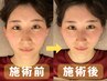 【再来】小顔矯正＋骨盤矯正オーダーメイドコース☆70分