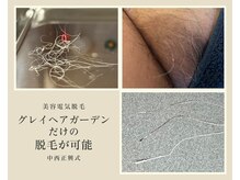 アール ピヴォワンヌ(R.pivoine)/気になる≪グレイヘア≫の脱毛