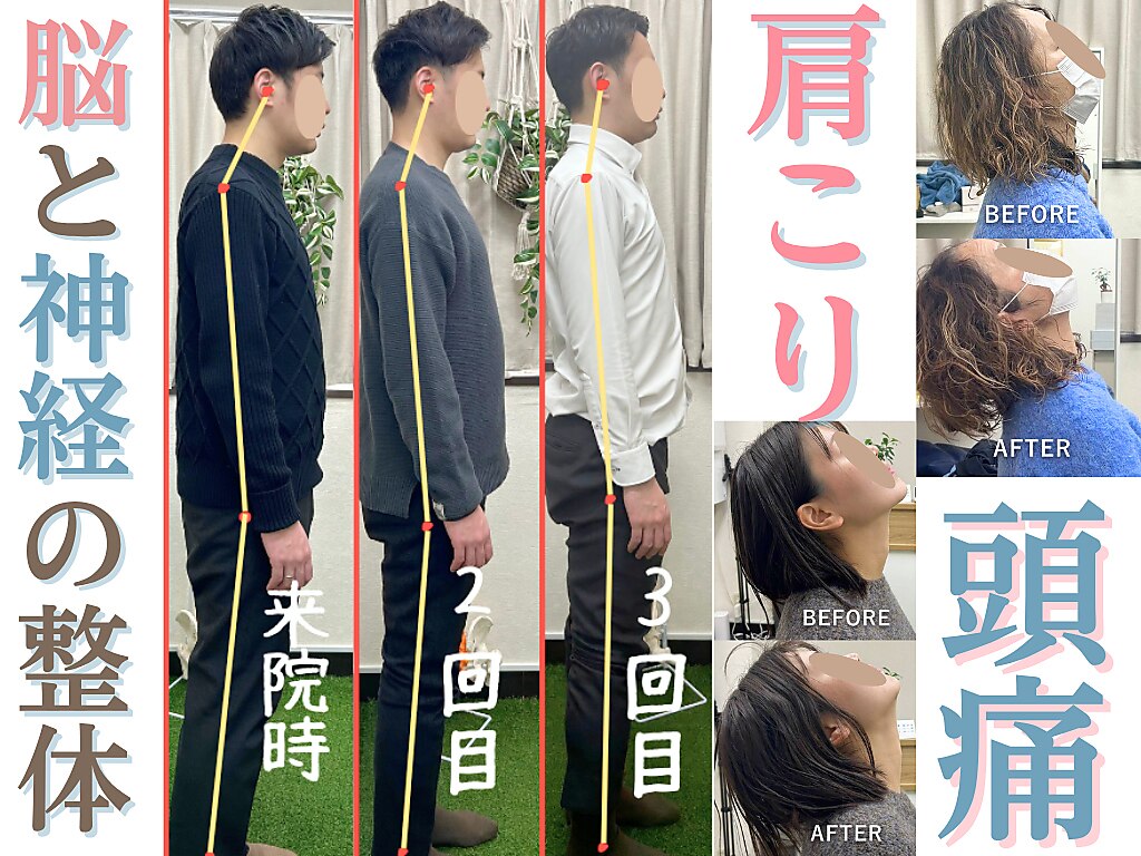 瞬く間にスルスル身体が緩む 脳内整体　治療院マーケティング研究所 宮本流 腰痛 足踏みスペシャル整体】宮本佳浩 整体 手技DVD 治療