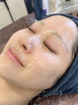 ロイヤル ビューティー サロン(Royal Beauty Saloon)の写真/【韓国セルマンで肌質管理×ピーリング】美白ケア効果◎ナイアシドアミド配合水分量UP/ニキビケア/毛穴レス