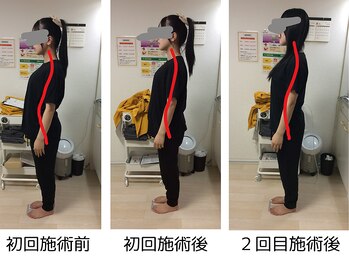 ストラボ 横浜店/ビフォーアフター１