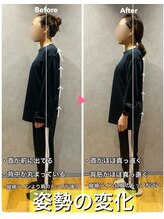 ヒーレンス(HEALENCE)/猫背＋ストレートネック！