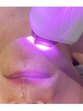 ビモア(Bmore)/★人気急上昇中LED脱毛★