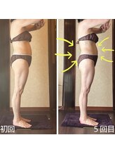 アーユルヴェーダアンドアロマエステ アユス(AYUS)/【５０代】痩身