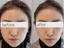 ダブリュー アイプラス 明石店(W eye+)の雰囲気（話題のセルフエステがご利用いただけます♪）