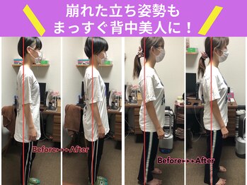 京都中丸整体カイロプラクティック/不良姿勢