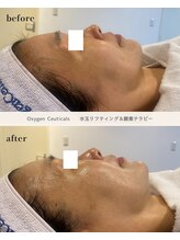 バイハル 原宿表参道(by HARU)/ビフォーアフター