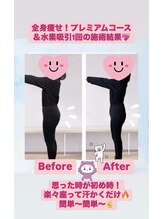 ヨサパーク ココル(YOSA PARK CoCoLu)/一回でも変化！！