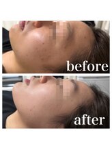 オリンピア 横浜(OLYMPIA)/