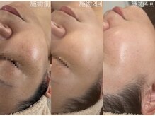 サロンドペシェ(salon de peche)の雰囲気(シミ・シワ緩和/くすみ改善/毛穴リフトUP等お悩み別コース3種)