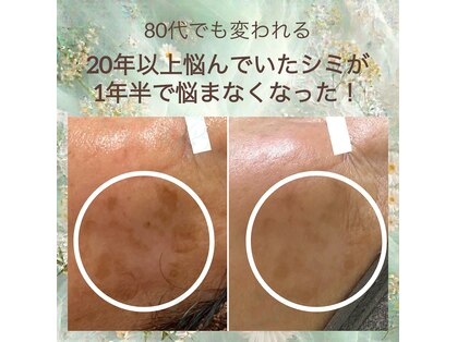 サロンリー(Salon Riee)の写真