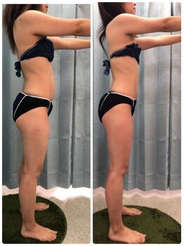 エスポワール(Espoir)/施術1回の効果