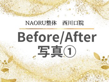 ナオル整体 西川口院(NAORU整体)/西川口 蕨 戸田 整体 骨盤矯正