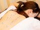 柿木園鍼灸 整体院の写真/マッサージで取れないコリを除去する鍼(はり)！健康が長持ちするツボに鍼◎鍼灸で肩こり腰痛の根本ケア！