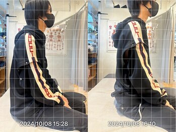 グレフル鍼灸接骨院 整体院 心斎橋/姿勢不良/骨盤矯正/全身整体