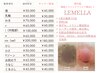 ルメラ【乳輪】黒ずみ・くすみ除去　モニターキャンペーン中