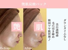 ダリア 豊橋(Dahlia)/小顔/毛穴引き締め/ツヤ肌