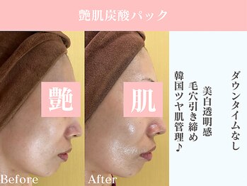 ダリア 豊橋(Dahlia)/小顔/毛穴引き締め/ツヤ肌