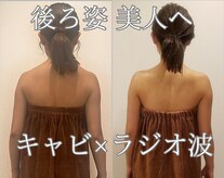 トータルエステティック ジョワイユ(JOYEUX)
