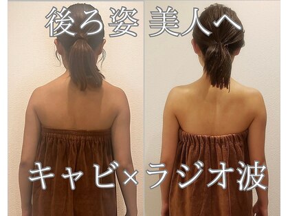 トータルエステティック ジョワイユ(JOYEUX)の写真