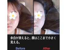 美容矯正サロン レレポノ(LELEPONO)/