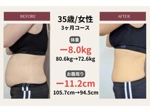 ピアリーノ(Pialino)/