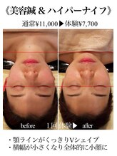 エモーション(Emotion)/小顔効果《八王子/エステ》