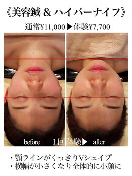 エモーション(Emotion)/小顔効果《八王子/エステ》