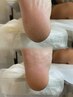 【美足★ツルツル】　足の角質除去+足裏　《60分》⇒4600