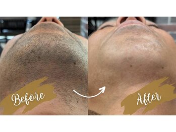 スタッド(STUD)の写真/【ムダ毛の悩みに★】完全都度払い×自分ペースで通えるBeautySalon◎2回目以降もお得なリピ割が人気!