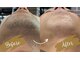 スタッド(STUD)の写真/【ムダ毛の悩みに★】完全都度払い×自分ペースで通えるBeautySalon◎2回目以降もお得なリピ割が人気!