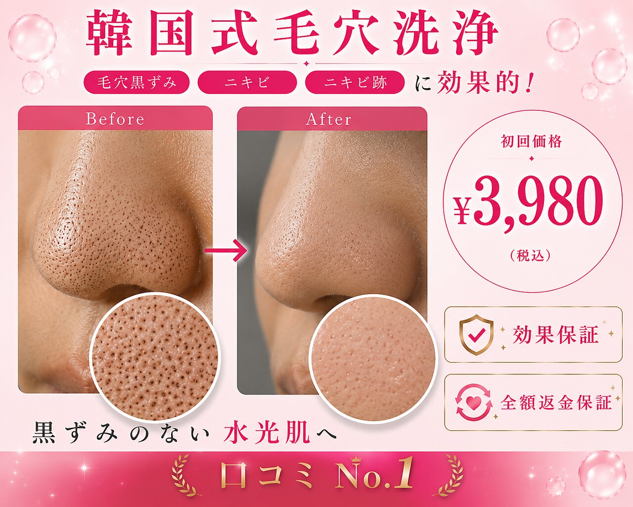 毛穴専科｜ホットペッパービューティー