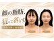 エン 橿原店(en)の写真/「痩せても顔だけ変わらない…」気になる丸顔・二重あごに。余分な脂肪にさようなら◎くっきりV字輪郭へ