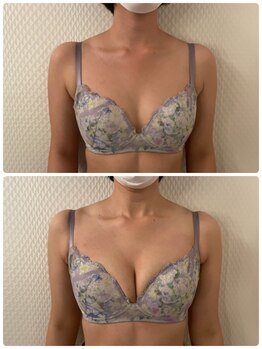 プレフィール(PLEAFEEL)/