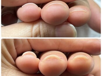 リコリコネイル(Riko Riko Nail)/自爪育成