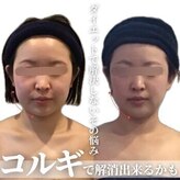 小顔フェイスラボ 浜松店(小顔FaceLabo.)