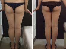 美容整体ウェリナ あま甚目寺院/小顔矯正/骨盤矯正/美脚サロン