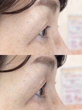 ダーム ド ローズ(Dame de rose)/【まぶたが上がるまつ毛パーマ】