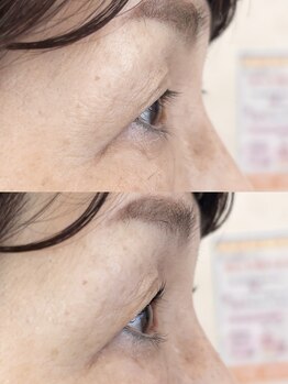 ダーム ド ローズ(Dame de rose)/【まぶたが上がるまつ毛パーマ】